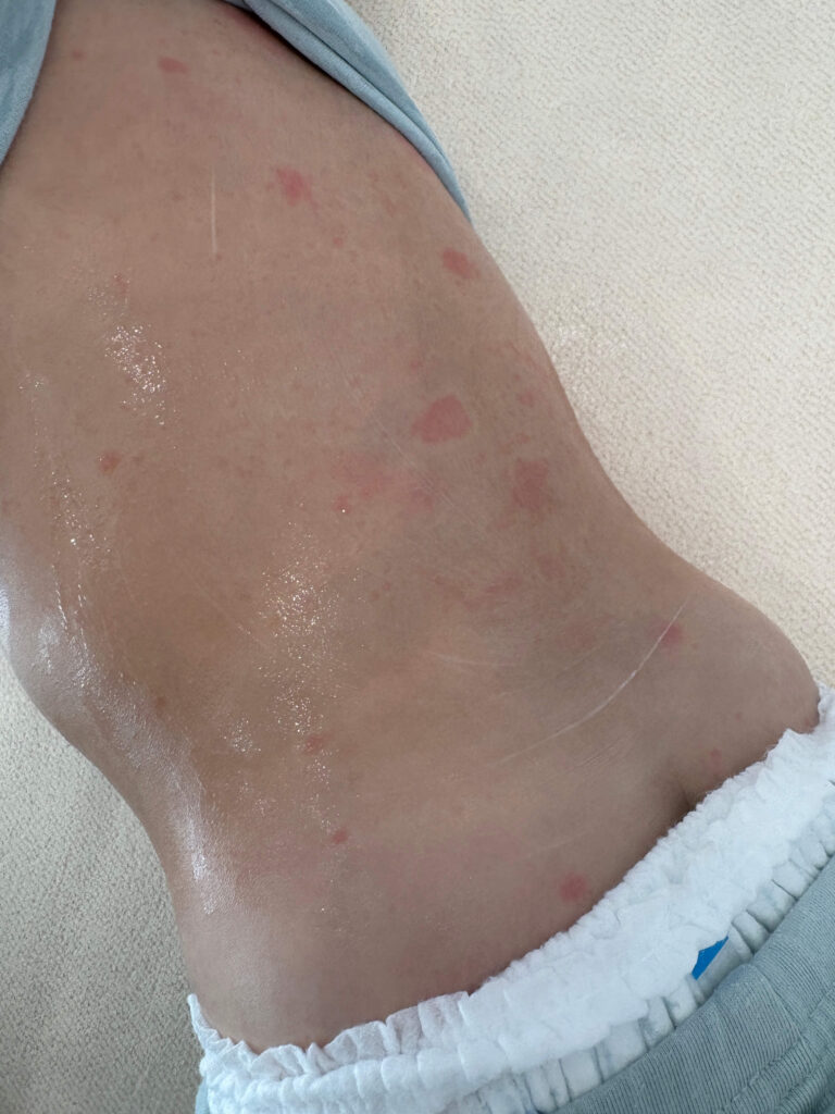 가와사키 발진